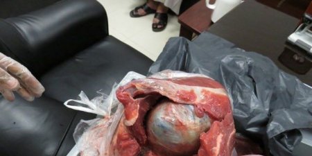 إحباط تهريب أكثر من 7 آلاف حبة «ترامادول» بمطار ينبع (صور)