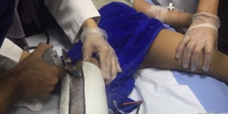 «مدني الخُبر» يفك احتجاز قدم طفل علقت في مرحاض (صور)
