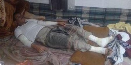 إصابة ثلاثة يمنيين بالسعودية بحروق جراء انفجار غاز منزلي.. الأسماء