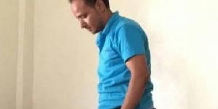 شابا من تعز بترت قدمه فصنع له قدم في منزله.. صورة