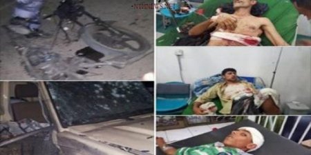 شهارة نت عاجل .. شهاره نت اخر الاخبار بالصور.. إصابة مدير عام شرطة إب واستشهاد أحد مرافقيه في عملية ارهابية