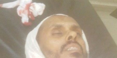 مقتل شيخ سلفي بارز في محافظة أبين (صورة)