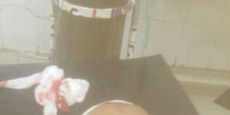 اغتيال شيخ سلفي بارز بمحافظة أبين بعد خروجه من صلاة التراويح