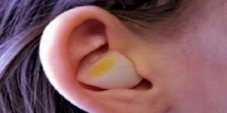 اخر اخبار اليمن العاجله هذا ما يحصل عند وضع البصل في أذنيك لليلة كاملة!
