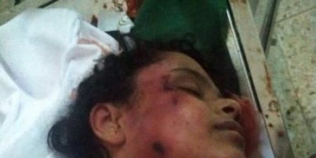 اليمن الان عاجل اخبار اليمن تفاصيل الجريمة التي هزت محافظة إب عامة و جبلة خاصة.. مصرع فتاة بعد تعذيبها بشكل وحشي من قبل خالها