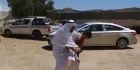 اليمن الان عاجل اخبار اليمن شاهد ماذا حدث لطفل بسبب الألعاب النارية؟ (فيديو)