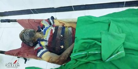المصدر اون لاين عاجل ارتفاع قتلى قصف المدنيين في تعز إلى 5 والمحافظ يتهم المجتمع الدولي بالتواطؤ